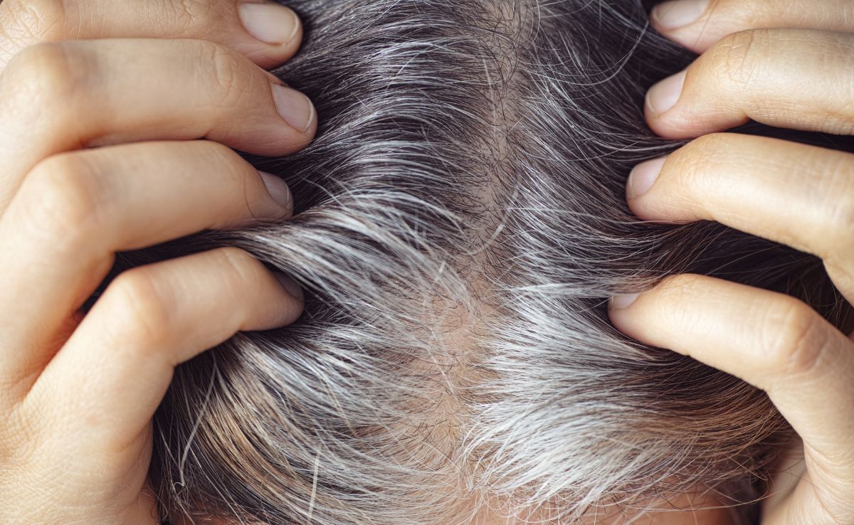 किस विटामिन की कमी से बाल होते हैं सफेद? जानिए इनको नेचुरली काला करने का रामबाण नुस्खा