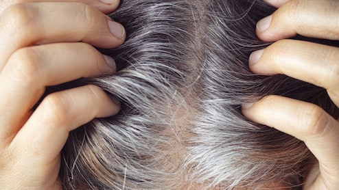 डाई और मेहंदी नहीं सफेद बालों को काला करने के लिए किचन में मौजूद इस चीज का ऐसे करें इस्तेमाल