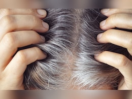 White Hair Remedies: पांढरे केस मुळासकट काळेभोर होतील, फॉलो करा या 5 टिप्स White Hair Remedies: पांढरे केस मुळासकट काळेभोर होतील, फॉलो करा या 5 टिप्स