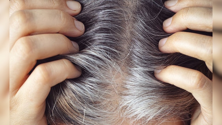 White Hair Remedies: पांढरे केस मुळासकट काळेभोर होतील, फॉलो करा या 5 टिप्स White Hair Remedies: पांढरे केस मुळासकट काळेभोर होतील, फॉलो करा या 5 टिप्स