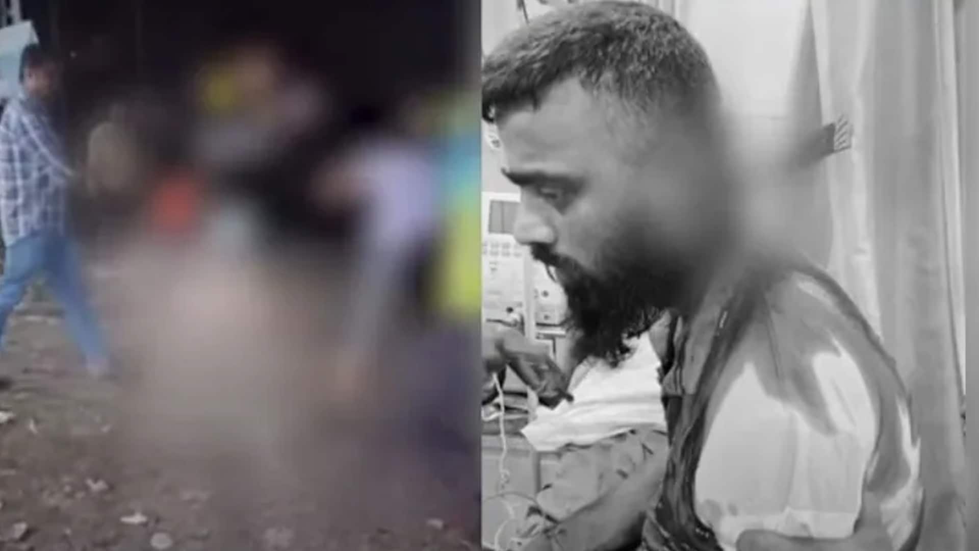 Video: Kerala Man Stabbed During Fight, Goes To Hospital With Knife In Neck