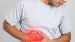 What Is A Hernia? Doctor Lists Everyday Activities That Might Increase Your Risk