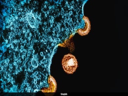 Century-Old Virus Therapy May Help Tackle Growing Antibiotic Resistance Crisis Century-Old Virus Therapy May Help Tackle Growing Antibiotic Resistance Crisis