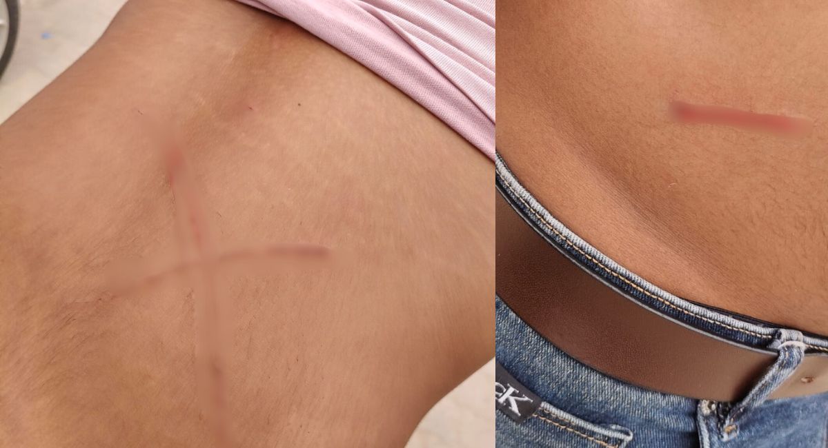 पेट और पीठ पर धारदार हथियार से हमला किया. पेट और पीठ पर धारदार हथियार से हमला किया.