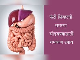 Fatty Liver: फॅटी लिव्हर होण्यामागे ही आहेत गंभीर कारणं, सुटका मिळवण्यासाठी काय खावं? वाचा संपूर्ण यादी Fatty Liver: फॅटी लिव्हर होण्यामागे ही आहेत गंभीर कारणं, सुटका मिळवण्यासाठी काय खावं? वाचा संपूर्ण यादी
