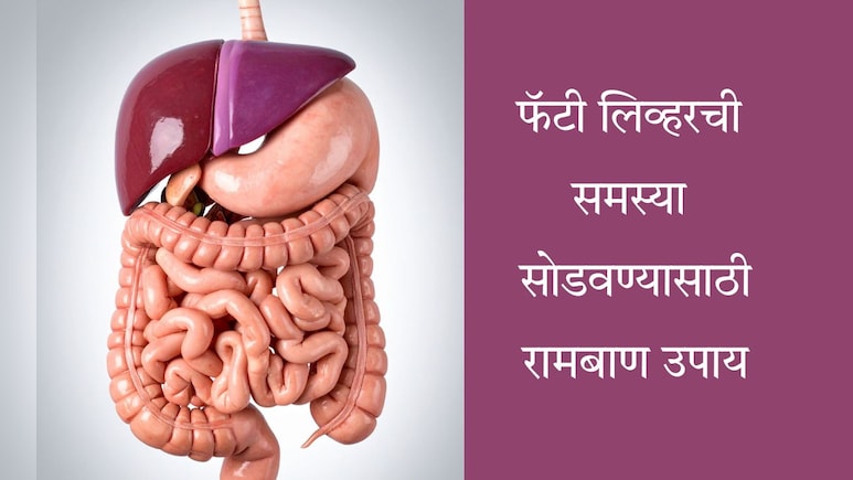 Fatty Liver: फॅटी लिव्हर होण्यामागे ही आहेत गंभीर कारणं, सुटका मिळवण्यासाठी काय खावं? वाचा संपूर्ण यादी Fatty Liver: फॅटी लिव्हर होण्यामागे ही आहेत गंभीर कारणं, सुटका मिळवण्यासाठी काय खावं? वाचा संपूर्ण यादी