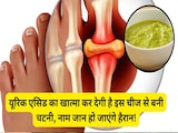 यूरिक एसिड बढ़ जाए तो क्या खाएं, यूरिक एसिड को कंट्रोल करती है इस चीज से बनी चटनी, इन लोगों के लिए वरदान से कम नहीं यूरिक एसिड बढ़ जाए तो क्या खाएं, यूरिक एसिड को कंट्रोल करती है इस चीज से बनी चटनी, इन लोगों के लिए वरदान से कम नहीं