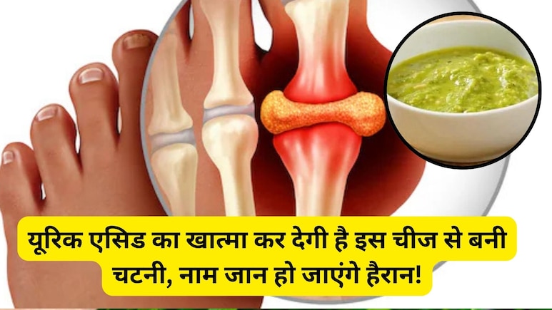 यूरिक एसिड बढ़ जाए तो क्या खाएं, यूरिक एसिड को कंट्रोल करती है इस चीज से बनी चटनी, इन लोगों के लिए वरदान से कम नहीं