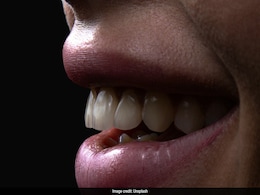 Viral Trend Of Getting Tattoos On Teeth Sparks Debate On Dental Health In China Viral Trend Of Getting Tattoos On Teeth Sparks Debate On Dental Health In China
