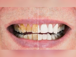 पीले दांतों को साफ करने के लिए हल्दी का इस्तेमाल कैसे करें? Doctor Hansaji ने बताए 2 असरदार तरीके