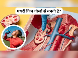 क्या पीने से किडनी में पथरी होती है? क्या पीने से किडनी में पथरी होती है?