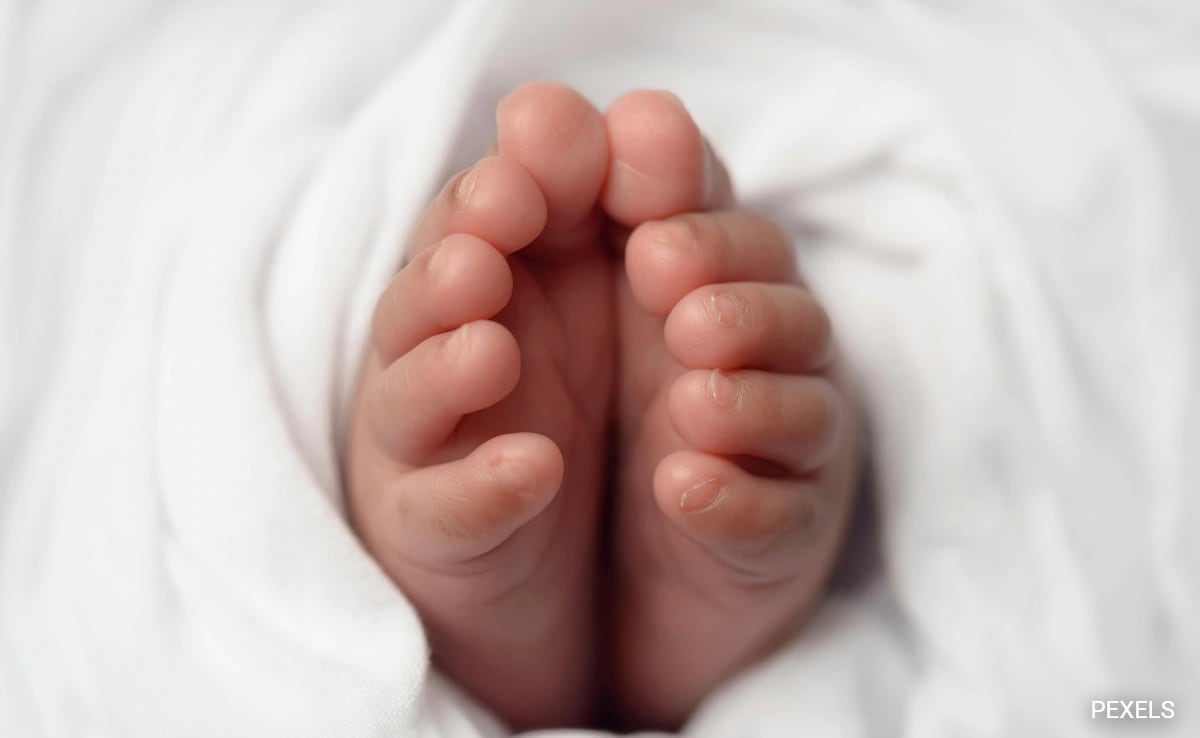 Rare 'Fetus in Fetu' Case Detected in Newborn in Karnataka
