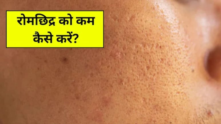 चेहरे के ओपन पोर्स कैसे बंद करें? डर्माटोलॉजिस्ट ने बताया क्या करने से स्मूद दिखेगी स्किन