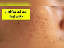 चेहरे के ओपन पोर्स कैसे बंद करें? डर्माटोलॉजिस्ट ने बताया क्या करने से स्मूद दिखेगी स्किन चेहरे के ओपन पोर्स कैसे बंद करें? डर्माटोलॉजिस्ट ने बताया क्या करने से स्मूद दिखेगी स्किन