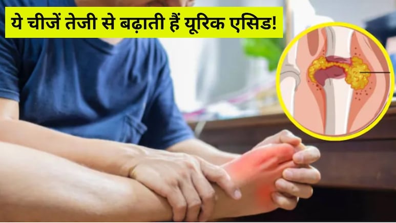 AIIMS की डॉक्टर ने बताया High Uric Acid में कभी नहीं खानी चाहिए ये 5 चीजें, खतरनाक हो जाएगी कंडीशन AIIMS की डॉक्टर ने बताया High Uric Acid में कभी नहीं खानी चाहिए ये 5 चीजें, खतरनाक हो जाएगी कंडीशन