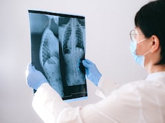 Study By Indian Doctor Couple Inspires Major WHO Change In Tuberculosis Treatment And Care