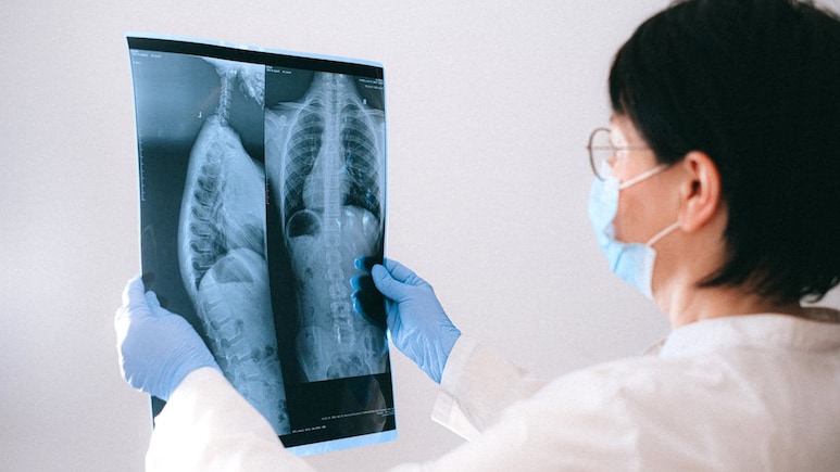 Study By Indian Doctor Couple Inspires Major WHO Change In Tuberculosis Treatment And Care