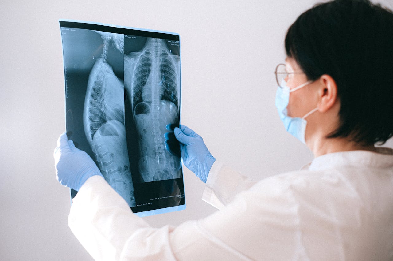 Study By Indian Doctor Couple Inspires Major WHO Change In Tuberculosis Treatment And Care