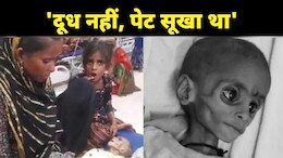 MP में 8 और 12 रुपये के बीच दम तोड़ता बचपन ! 3 महीने में तीसरी मौत, मंत्री बोलीं- कुपोषण ग्लोबल समस्या
