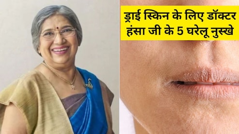बदलते मौसम में ड्राई हो रही है स्किन? अपनाएं डॉक्टर हंसा जी के बताए ये 5 घरेलू नुस्खे, रूखेपन से मिलेगा छुटकारा