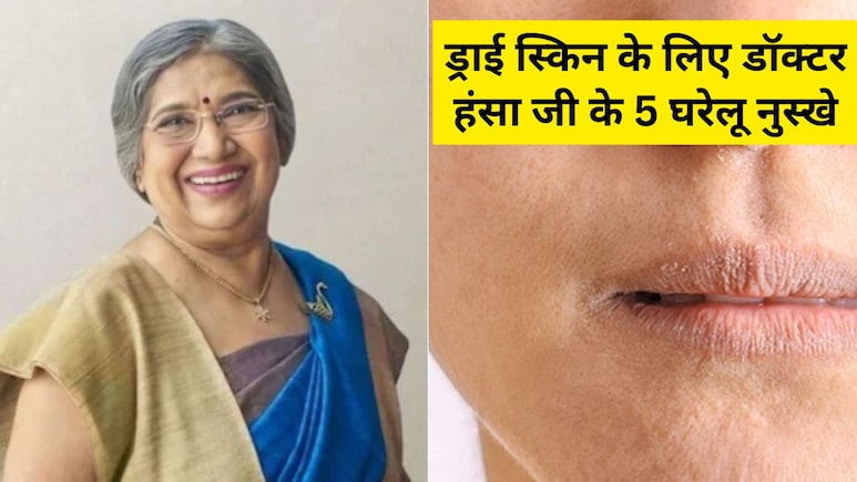 बदलते मौसम में ड्राई हो रही है स्किन? अपनाएं डॉक्टर हंसा जी के बताए ये 5 घरेलू नुस्खे, रूखेपन से मिलेगा छुटकारा