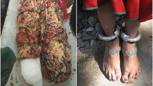 दरिंदगी की हद! मजदूरी के बहाने महिला को बुलाया, दोनों पैर काटकर डेढ़ किलो चांदी के कड़े लूटे; गंगापुर सिटी में दहशत