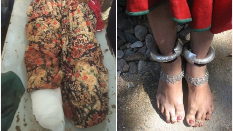 दरिंदगी की हद! मजदूरी के बहाने महिला को बुलाया, दोनों पैर काटकर डेढ़ किलो चांदी के कड़े लूटे; गंगापुर सिटी में दहशत दरिंदगी की हद! मजदूरी के बहाने महिला को बुलाया, दोनों पैर काटकर डेढ़ किलो चांदी के कड़े लूटे; गंगापुर सिटी में दहशत