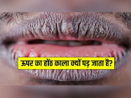 ऊपर का होंठ काला क्यों पड़ जाता है? डॉक्टर से जानें होंठों का कालापन दूर करने के लिए क्या करें ऊपर का होंठ काला क्यों पड़ जाता है? डॉक्टर से जानें होंठों का कालापन दूर करने के लिए क्या करें