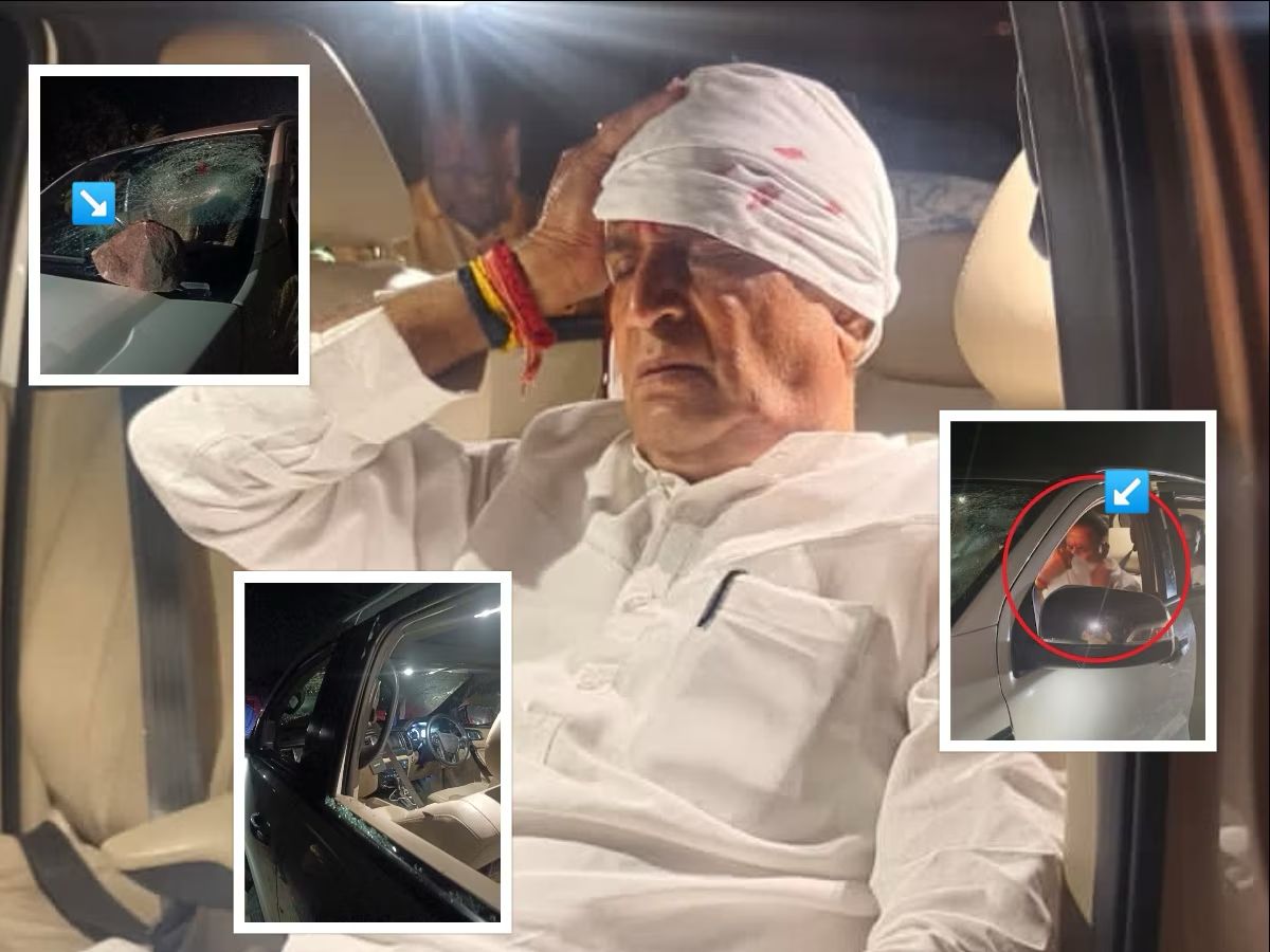 खून के धब्बे और चोटें... अनिल देशमुख पर हमले की क्या है सच्चाई? पुलिस की जांच ने खोली पोल