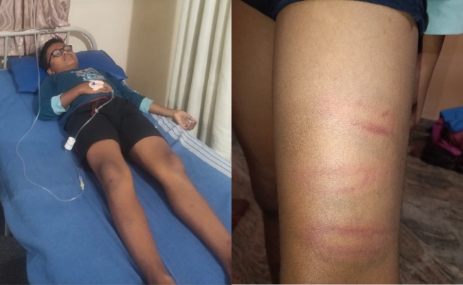 Bengaluru Boy, 9, In Hospital After School Principal Thrashes Him With Pipe