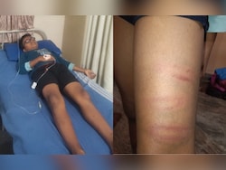 Bengaluru Boy, 9, In Hospital After School Principal Thrashes Him With Pipe