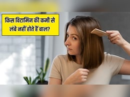 किस विटामिन की कमी से बाल नहीं बढ़ते हैं? एक ही जगह रुक गई है Hair Growth तो आज ही करा लें टेस्ट किस विटामिन की कमी से बाल नहीं बढ़ते हैं? एक ही जगह रुक गई है Hair Growth तो आज ही करा लें टेस्ट