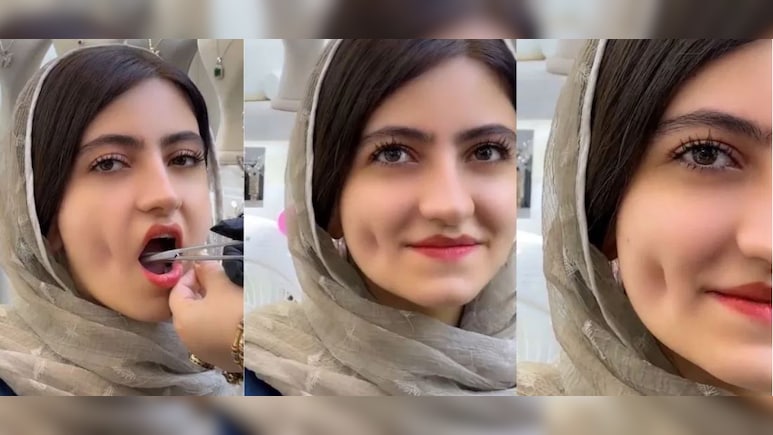 उफ्फ ये स्माइल! गाल पर डिंपल बनाने का ये जुगाड़ देख लोगों के छूटे पसीने, क्या आपने देखा?