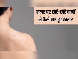 पीठ पर छोटी-छोटी फुंसी क्यों होती हैं? डॉक्टर से जानें कैसे पाएं Back Acne से छुटकारा पीठ पर छोटी-छोटी फुंसी क्यों होती हैं? डॉक्टर से जानें कैसे पाएं Back Acne से छुटकारा