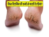 किस विटामिन की कमी से फटती हैं एड़ियां? डॉक्टर ने बताए एड़ियों के फटने के 5 बड़े कारण किस विटामिन की कमी से फटती हैं एड़ियां? डॉक्टर ने बताए एड़ियों के फटने के 5 बड़े कारण