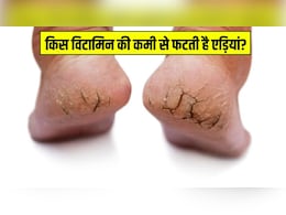 किस विटामिन की कमी से फटती हैं एड़ियां? डॉक्टर ने बताए एड़ियों के फटने के 5 बड़े कारण किस विटामिन की कमी से फटती हैं एड़ियां? डॉक्टर ने बताए एड़ियों के फटने के 5 बड़े कारण
