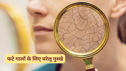 फटे गालों ने कर दी चेहरे की खूबसूरती फीकी? आज ही अपना लें ये 3 घरेलू नुस्खे, हो जाएंगे बेहद मुलायम