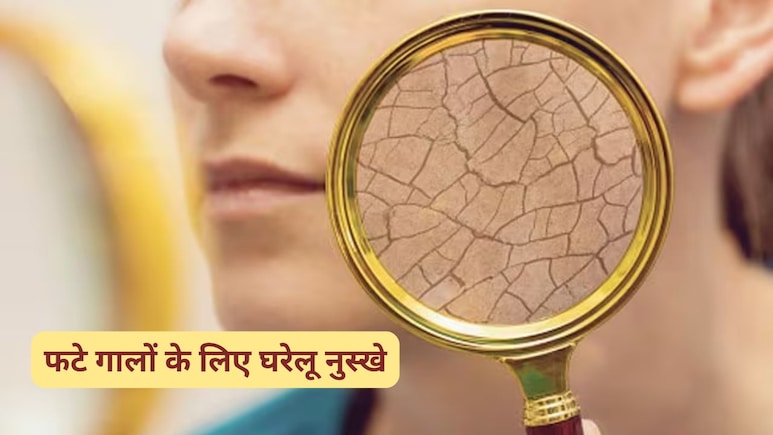 फटे गालों ने कर दी चेहरे की खूबसूरती फीकी? आज ही अपना लें ये 3 घरेलू नुस्खे, हो जाएंगे बेहद मुलायम फटे गालों ने कर दी चेहरे की खूबसूरती फीकी? आज ही अपना लें ये 3 घरेलू नुस्खे, हो जाएंगे बेहद मुलायम