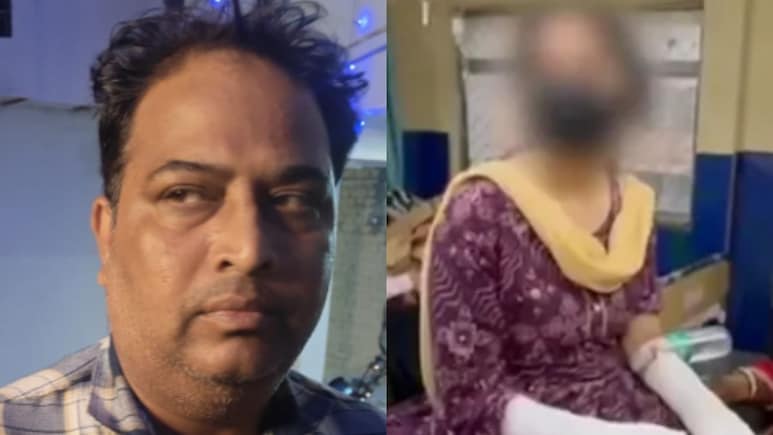 He Let Daughter's Hands Burn To Cover Up Rape. How Police Unravelled Plot He Let Daughter's Hands Burn To Cover Up Rape. How Police Unravelled Plot