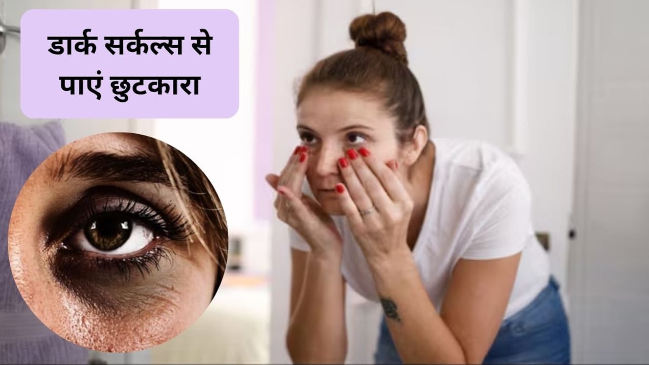 घर पर तुरंत डार्क सर्कल कैसे हटाएं? जानिए घर पर कैसे बनाएं आइज क्रीम