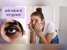 घर पर तुरंत डार्क सर्कल कैसे हटाएं? जानिए घर पर कैसे बनाएं आइज क्रीम