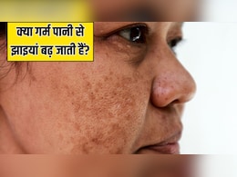 क्या गर्म पानी में नहाने से झाइयां बढ़ जाती हैं? स्किन की डॉक्टर ने बताया कैसा होगा चेहरे पर असर क्या गर्म पानी में नहाने से झाइयां बढ़ जाती हैं? स्किन की डॉक्टर ने बताया कैसा होगा चेहरे पर असर