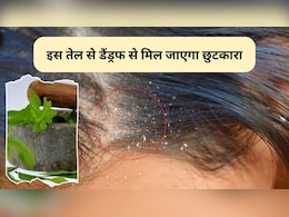 Dandruff And Hair Tips: डैंड्रफ से हैं परेशान तो इस जादुई तेल को लगाने से समस्या हो जाएगी दूर, बालों की ग्रोथ भी होगी जल्दी Dandruff And Hair Tips: डैंड्रफ से हैं परेशान तो इस जादुई तेल को लगाने से समस्या हो जाएगी दूर, बालों की ग्रोथ भी होगी जल्दी