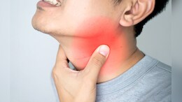 बार-बार गले में दर्द? हो सकता है टॉन्सिल्स की समस्या, जानें उपाय