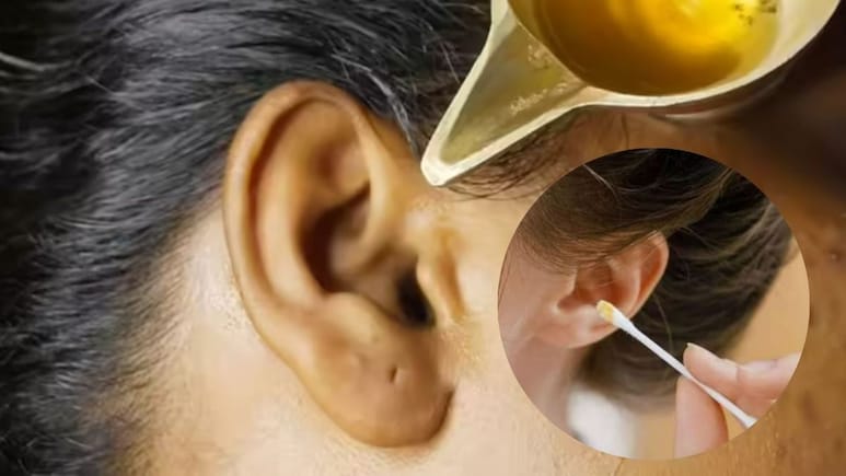 कान का मैल निकालने के लिए आप भी करते हैं कॉटन स्टिक का इस्तेमाल? डॉक्टर ने बताया सही तरीका
