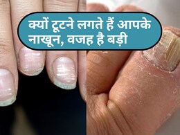 कमजोर और टूटते नाखूनों को न करें इग्नोर, ये हैं शरीर की अंदरूनी बीमारी का बड़ा संकेत कमजोर और टूटते नाखूनों को न करें इग्नोर, ये हैं शरीर की अंदरूनी बीमारी का बड़ा संकेत