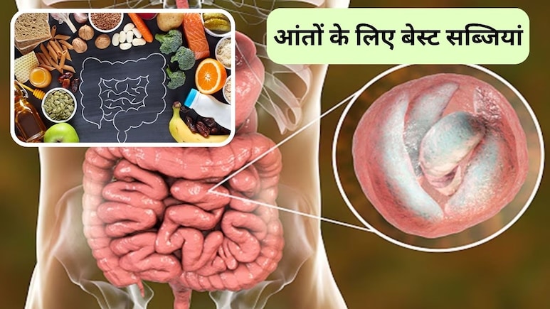 आंतों की सफाई कैसे करें? AIIMS के डॉक्टर ने कहा सर्दी में ये 5 सब्जियां खाना कर दें शुरू आंतों की सफाई कैसे करें? AIIMS के डॉक्टर ने कहा सर्दी में ये 5 सब्जियां खाना कर दें शुरू