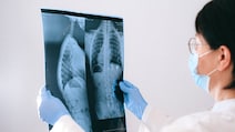 Winter Health Tips: These Exercises Can Boost Your Lung Health