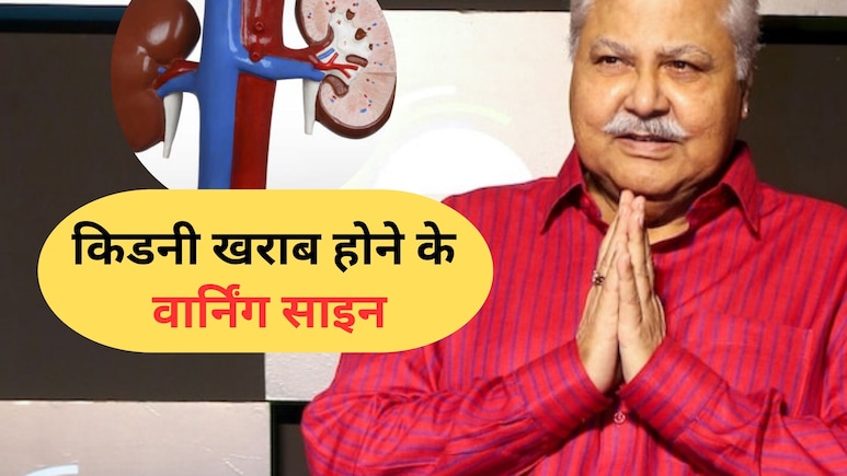 हंसाने वाला 'इंद्रवदन' रुला गया: एक्टर सतीश शाह की Kidney failure से मौत, आप इन लक्षणों को न करें नजरअंदाज हंसाने वाला 'इंद्रवदन' रुला गया: एक्टर सतीश शाह की Kidney failure से मौत, आप इन लक्षणों को न करें नजरअंदाज