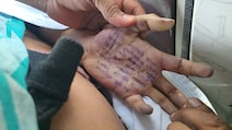 BJP vs Opposition Over Ex-MP's Mention In Maharashtra Doctor's Suicide Note